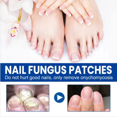 Clear Nail™ - Fungal Nail Renewal Patches