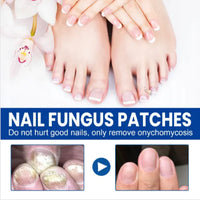 Clear Nail™ - Fungal Nail Renewal Patches